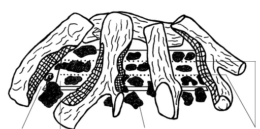 [322372] Jeu céramique de set bois Unica 50 5-pièces